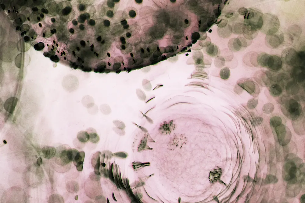 ETS Enfermedades de Transmisión Sexual Saludarea.mx