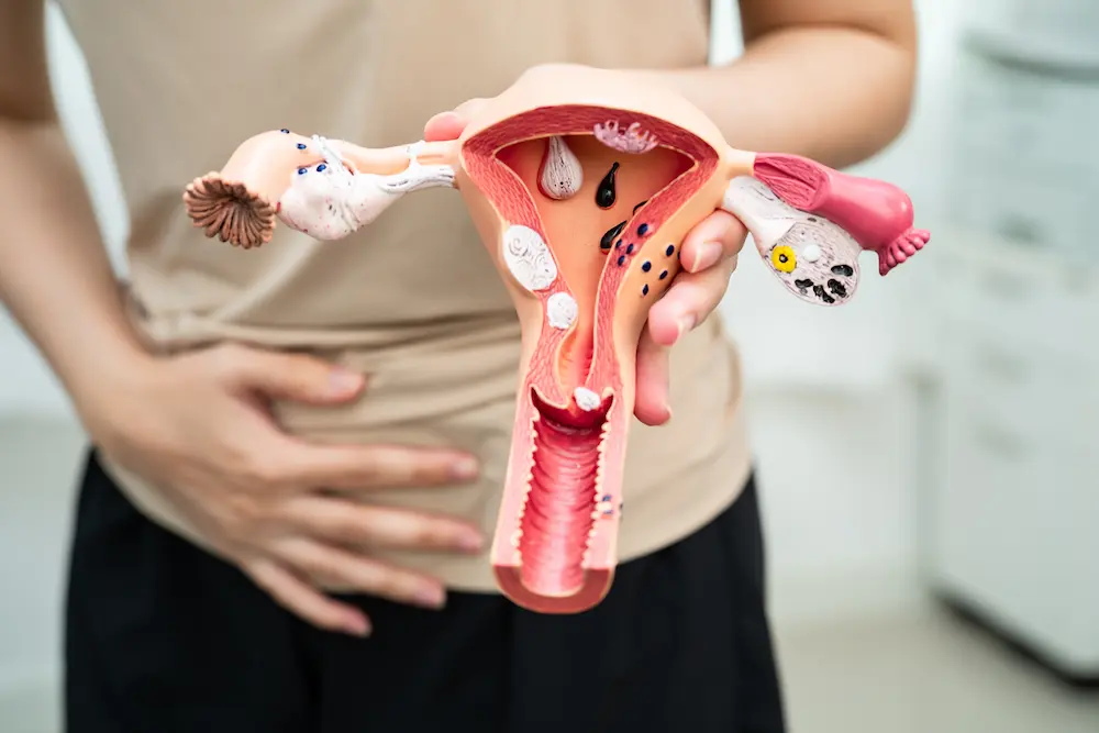 Ginecología Saludarea.mx